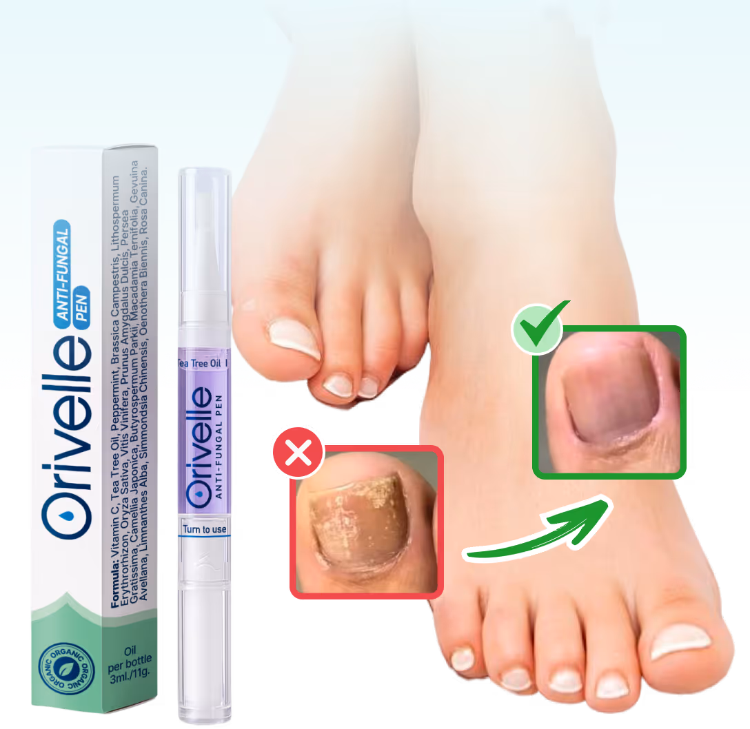 Orivelle Erfahrungen und Test 2026: Anti-Pilz-Stift gegen Nagelpilz mit Verpackung und Vorher-Nachher-Zehennagel
